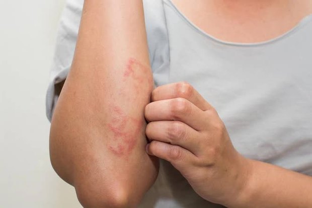 4 bất thường trên da là dấu hiệu của ung thư nhưng rất nhiều người không hề biết, muốn ngăn ngừa ung thư da hãy làm 4 việc và ăn thêm 3 thứ